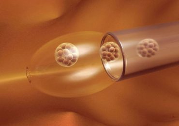 Inseminação Artificial